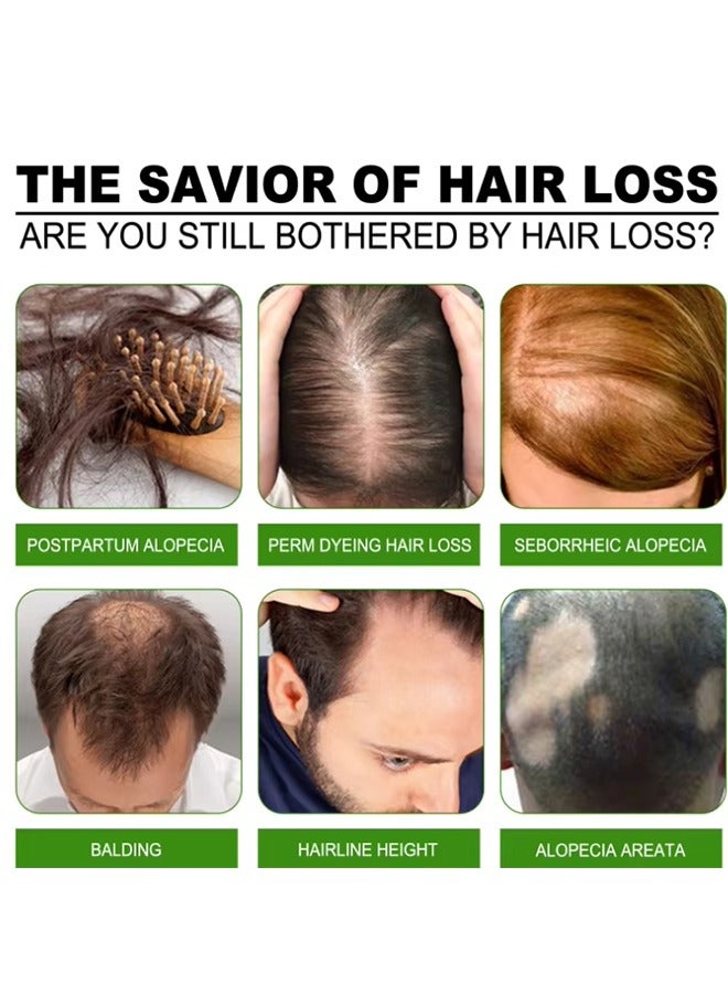 ساوث مون رذاذ الزنجبيل المغذي للشعر، رذاذ الزنجبيل المعدل للنمو الشعر المصل للرجال والنساء رذاذ النمو الطبيعي 100ML - Image 4