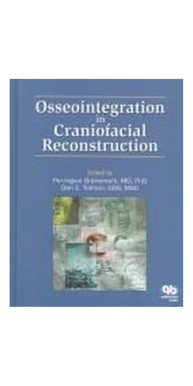 Osseointegration in craniofacial reconstruction | Paperback | Published by Quintessence