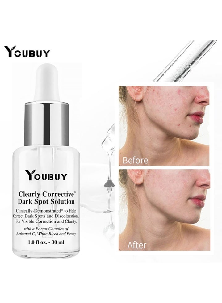 YOUBUY Whitening Essence-Clearly Corrective  Dark Spot Solution for Dark Spots, Blackheads & Clogged Pores, Brightening Facial Serum, Reduces Hyperpigmentation & Post-acne Marks, with Vitamin C & Salicylic Acid, All Skin Types, Paraben-free, Mineral Oil-free 30ml - Image 1