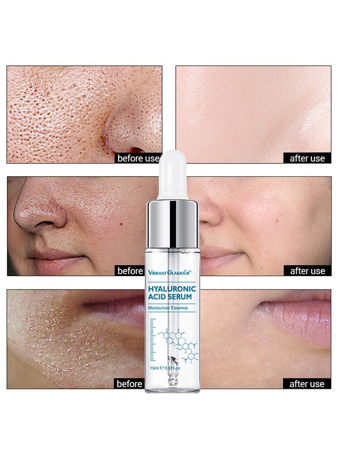 Vibrant Glamour - Hyaluronic Acid Serum，Pure Hyaluronic Acid Serum Hides Wrinkles Enhances Elasticity Anti Aging 15ml - Image 1