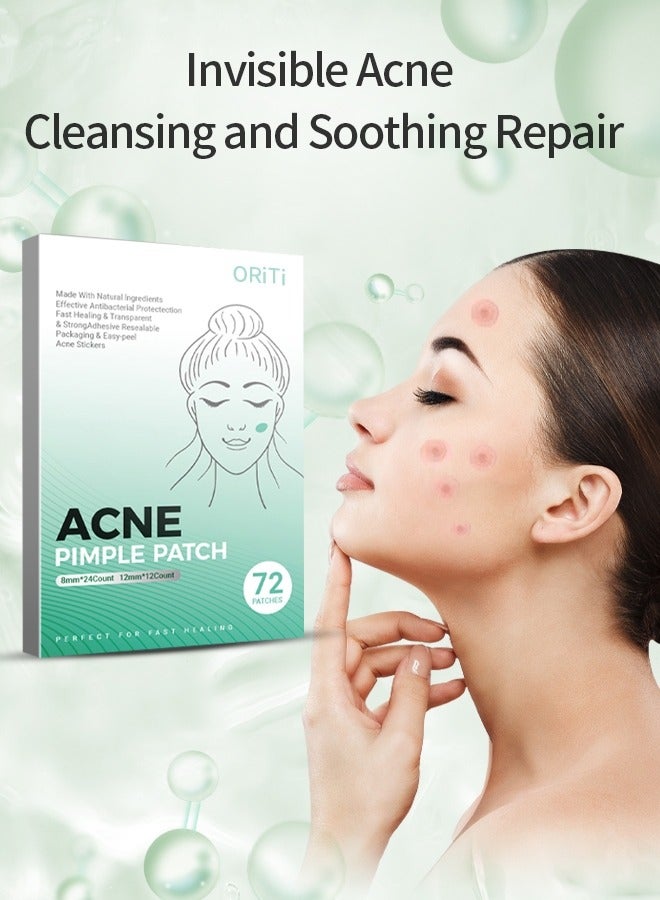 ORiTi ACNE PIMPLE PATCH - Image 1