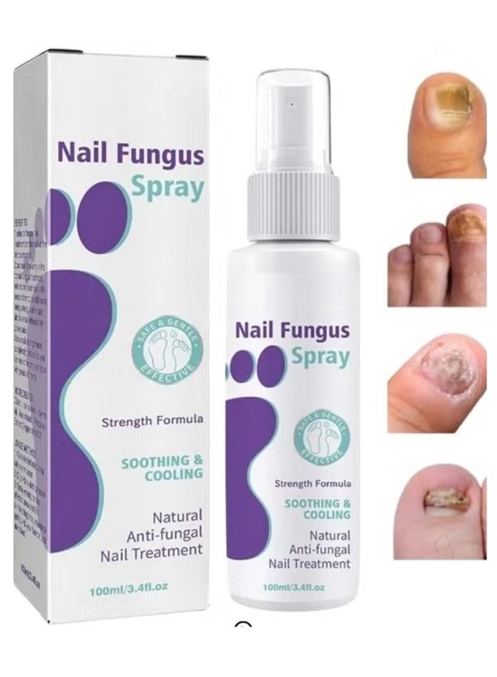 Jaysuing 100ml Nail Fungus Spray Soothing and Cooling Natural Anti-Fungal Nail Treatment Spray Effective Feet Infections Athlete Foot Nail Fungus Hand And Foot Care Fungi Spray - Image 1