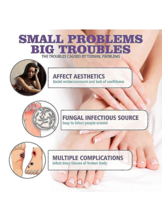 Jaysuing 100ml Nail Fungus Spray Soothing and Cooling Natural Anti-Fungal Nail Treatment Spray Effective Feet Infections Athlete Foot Nail Fungus Hand And Foot Care Fungi Spray - Image 2