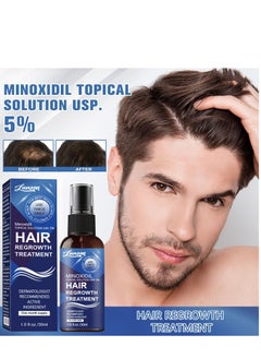 LUNOON Minoxidil Hair Regrowth Treatment - Growth Spray For Men and Women , 5% Minoxidil Hair Serum For Stronger Thicker Longer Hair Help to Stop Thinning and Loss Hair 30ml  - Image 1