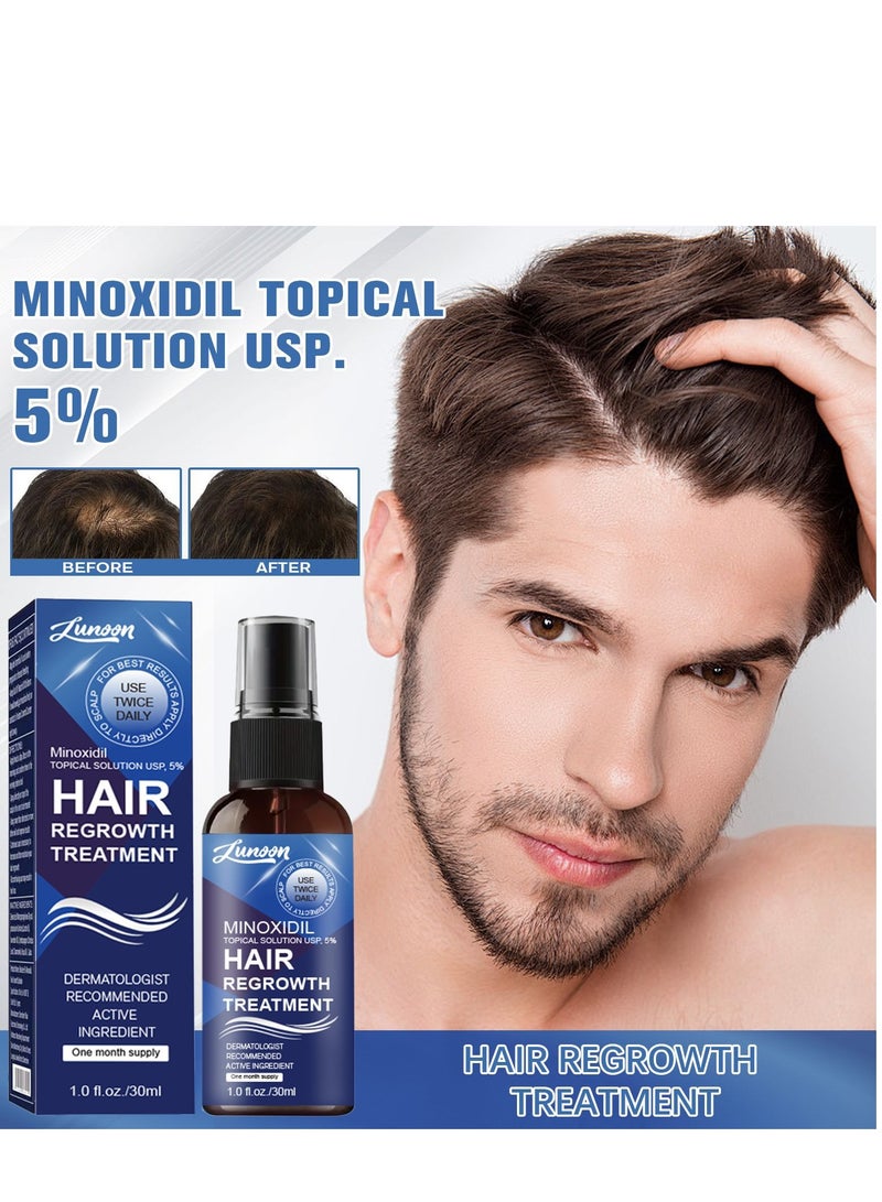 LUNOON Minoxidil Hair Regrowth Treatment - Growth Spray For Men and Women , 5% Minoxidil Hair Serum For Stronger Thicker Longer Hair Help to Stop Thinning and Loss Hair 30ml - Image 1