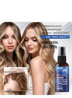 LUNOON Minoxidil Hair Regrowth Treatment - Growth Spray For Men and Women , 5% Minoxidil Hair Serum For Stronger Thicker Longer Hair Help to Stop Thinning and Loss Hair 30ml  - Image 2