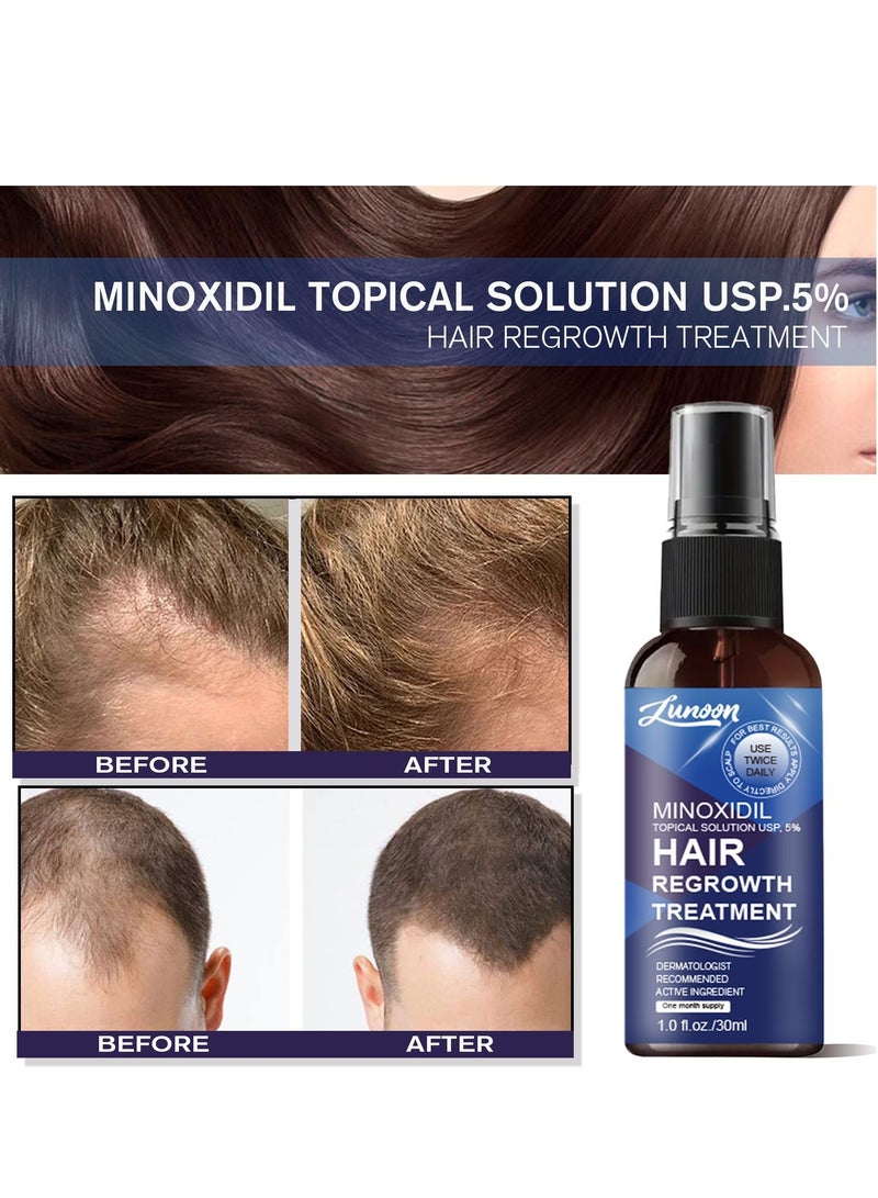 LUNOON Minoxidil Hair Regrowth Treatment - Growth Spray For Men and Women , 5% Minoxidil Hair Serum For Stronger Thicker Longer Hair Help to Stop Thinning and Loss Hair 30ml - Image 3