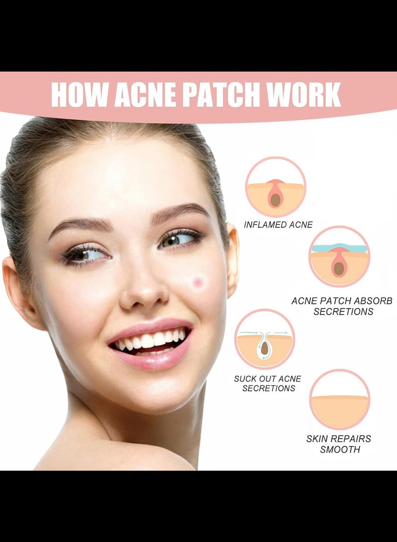 Generic 36-Piece Invisible Acne Pimple Patch (Clear)  - Image 3