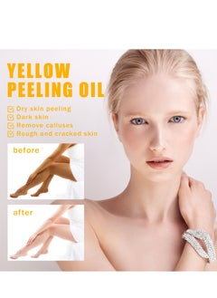 OUHOE 100ml Super Strength Yellow Peeling Oil Exfoliating Dark Skin for Body, Yellow Peeling Oil Body Whitening Skins, Butter Peeling Lightening Brighten Complexion for Cleansing and Moisturizing  - Image 4