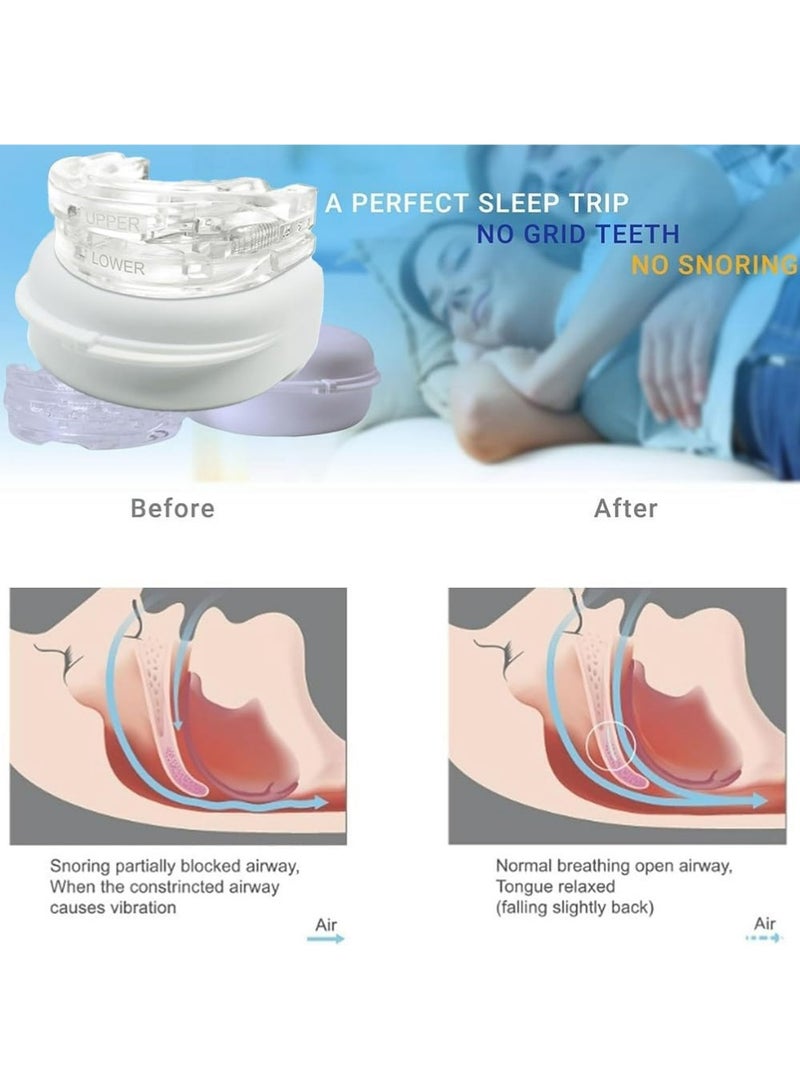 LLASIDO Nighttime Dental Mouthguard - Bite Nightguard for Sleep to Reduce Clenching & Pain - Image 5