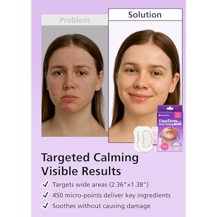 DWEasyDerm لصقات المغنيسيوم السريعة من إيزي ديرم - 2 لصقة كبيرة للوجه لعلاج حب الشباب، ميكرو دوت الفيرالي على تيك توك، مع أمبول صغير إضافي من سيكا - Image 3
