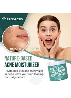 TreeActiv TreeActiv Salicylic Acid Face Moisturizer, 2 fl oz, Acne Treatment Face Cream for Oily Skin with and Tea Tree Oil, For Teens and Adults with Acne Prone Skin and Cystic Acne, 90 Day Supply  - Image 2