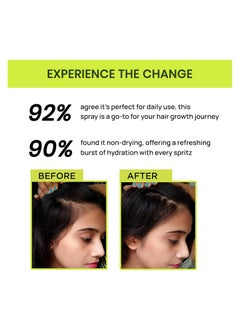 ALPS GOODNESS Alps Goodness Rosemary Water Spray For Hair Growth Twin Pack (200 ml x 2) | Hair Spray for Regrowth | Rosemary Hair Mist | Adds Shine | Helps Reduce Hairfall | Strengthens Hair | For All Hair Types  - Image 3