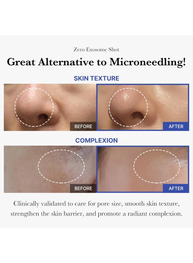 ميديكيوب ميديكوب سيروم الوجه زيرو اكسوسوم شوت 2000 جزء في الدقيقة سيروم سائل معزز للبشرة اكسوسوم AHA+BHA+PHAللعناية بالمسام وخلايا الجلد الميتة وملمس البشرة 30 مل - Image 2
