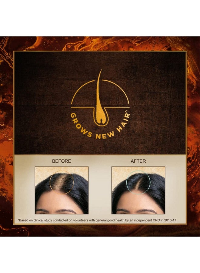 INDULEKHA زيت الشعر إندوليكا برينغا، زيت شعر أيورفيدي، 250 مل، للتحكم في تساقط الشعر، مع الأملا وزيت جوز الهند، مع مشط للتطبيق - Image 3