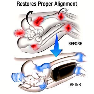 PumPum PUM PUM Orthopaedic Knee Pillow for Sciatica Relief Back Pain Leg Pain Pregnancy Hip and Joint Pain Memory Foam Knee Leg PillowBlack - Image 4