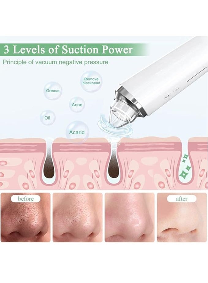 Generic Blackhead Remover Pore Vacuum, WiFi Visible Facial Pore Cleanser With HD Camera Pimple Acne Comedone Extractor Kit With 6 Suction Heads Electric Blackhead - Image 2