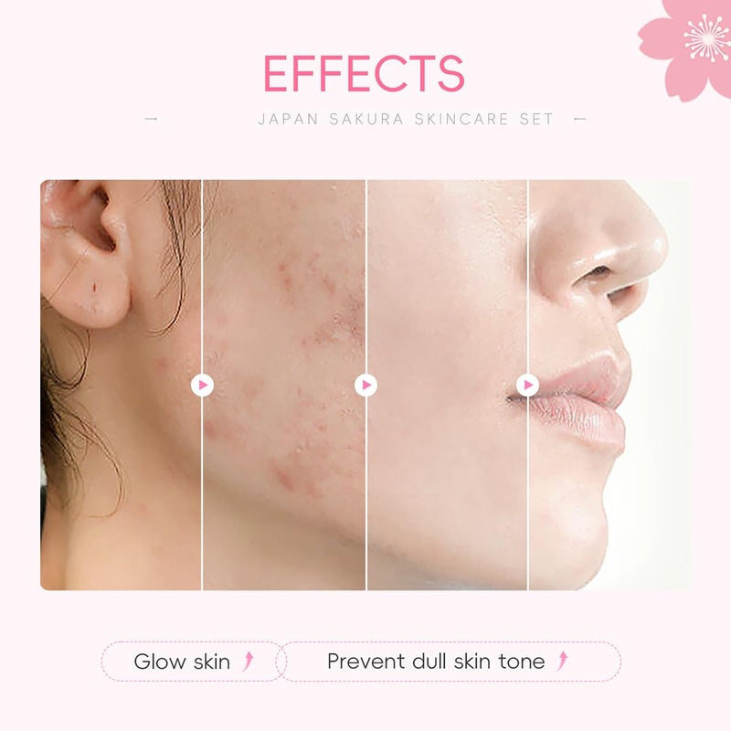 Tiejdhr 8 Pcs SakuraSkincare Set Complete Facial Care with Vitamin C Includes Cleanser TonerSerum Eye Cream Essence Cream Sakura hairpin Sakura hair rope Pink octopus face wash massager - Image 3