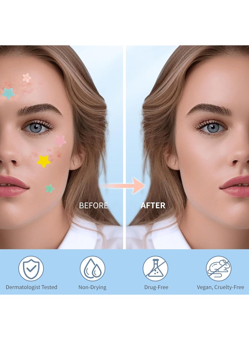 357 Piece Facial Acne Patches, Colored Hydrocolloid Pimple Patches, Cute Facial Star Stickers, Tea Tree Acne Patches, Salicylic Acid and Mica Oil | 4 sizes (8mm, 10mm, 12mm, and 14mm) - Image 4