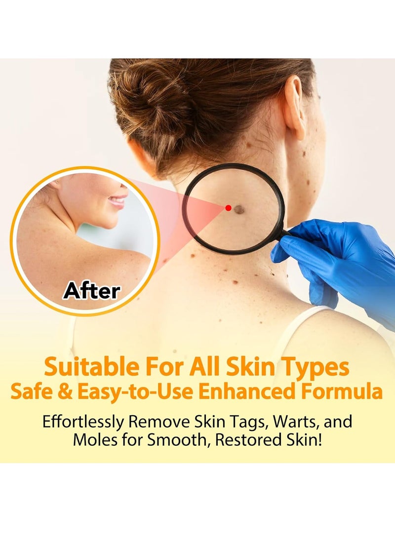 Sefudun 60ml Bee Venom Wart Remover Spray Skin Tag Removal Safe and Painless Clear Skin Tag and Mole Skin Tag Remover for All Skin Types Tag Recede Bee Venom Spray  - Image 4