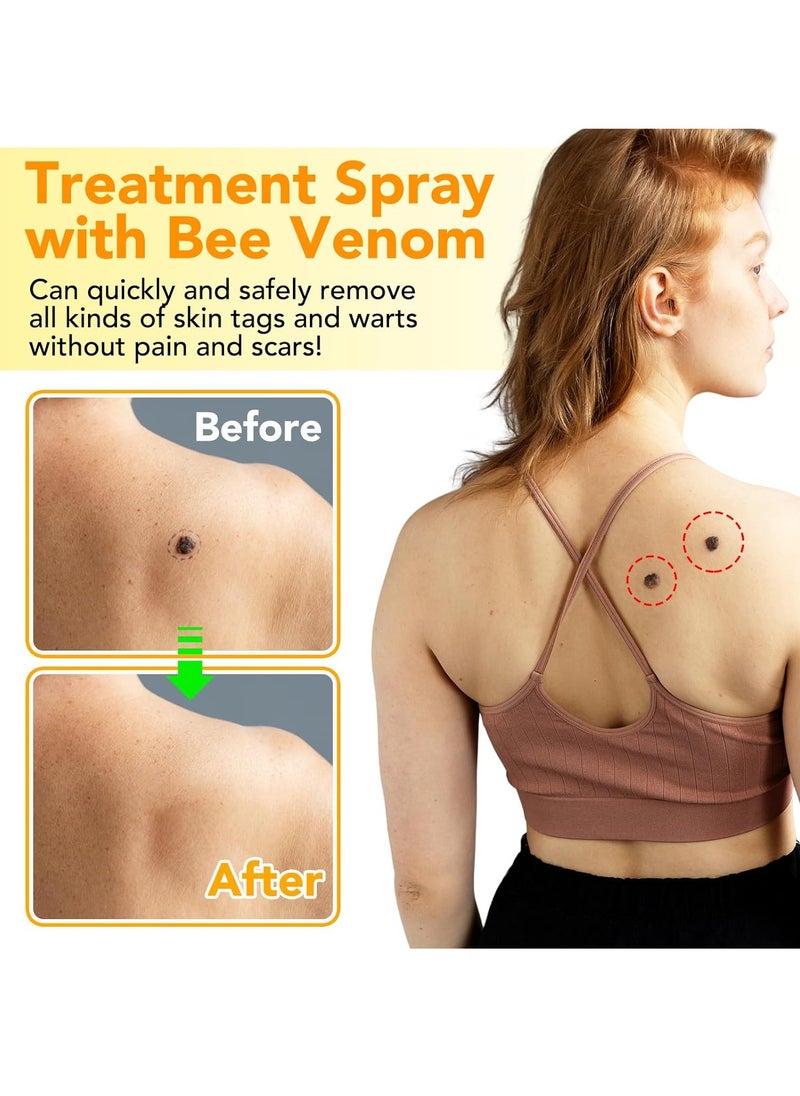 Sefudun 60ml Bee Venom Wart Remover Spray Skin Tag Removal Safe and Painless Clear Skin Tag and Mole Skin Tag Remover for All Skin Types Tag Recede Bee Venom Spray  - Image 5