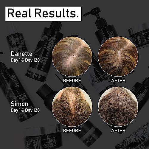 EVOLIS Prevent Anti-Aging Conditioner, Natural Anti Hair Loss Conditioner for Men and Women - Ideal for Sensitive, Dry Scalp and Oily Hair - Preventative Hair Loss Treatment (8.5 fl oz) - Image 3