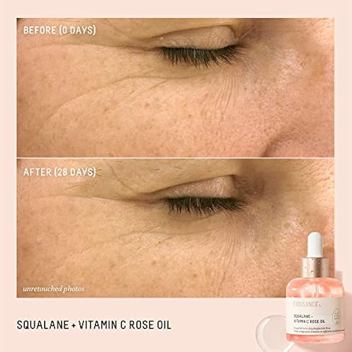 BIOSSANCE Squalane + Vitamin C Rose Advanced Facial Oil - Brightening, Firming, and Hydrating Serum for All Skin Types - Chios Crystal Oil, Damascus Rose Extract & Squalane for Radiance - Image 2