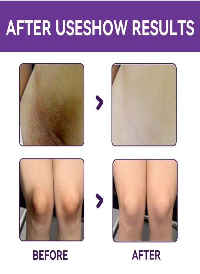 NORTH MOON - Underarm Cream, Effectively Lighten Dark Underarm Gentle on the Skin, Soothe and Hydrate, Safe Ingredients Nourishing Formula Fast-Absorbing Long-Lasting Easy to Use for All Skin Types - Image 1