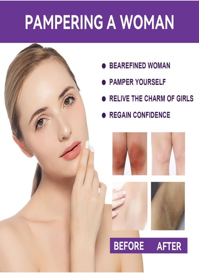 NORTH MOON - Underarm Cream, Effectively Lighten Dark Underarm Gentle on the Skin, Soothe and Hydrate, Safe Ingredients Nourishing Formula Fast-Absorbing Long-Lasting Easy to Use for All Skin Types - Image 1