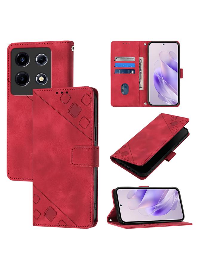 Zaboon Case For Infinix Note 30 VIP Skin Feel Embossed Leather Phone Case - Image 1