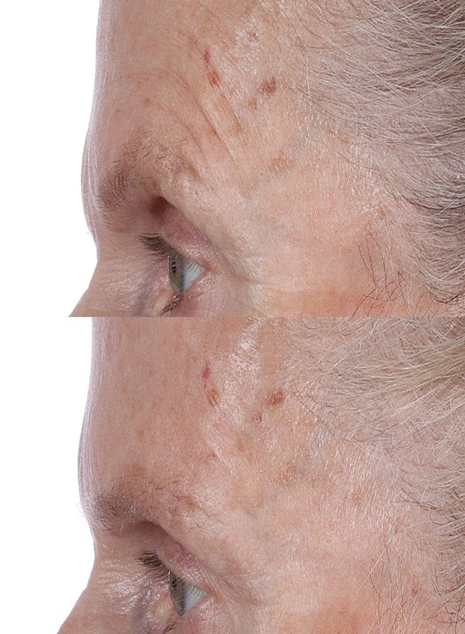 Perricone MD High Potency Face Finishing & Firming Toner, 4 fl. oz. - Image 4