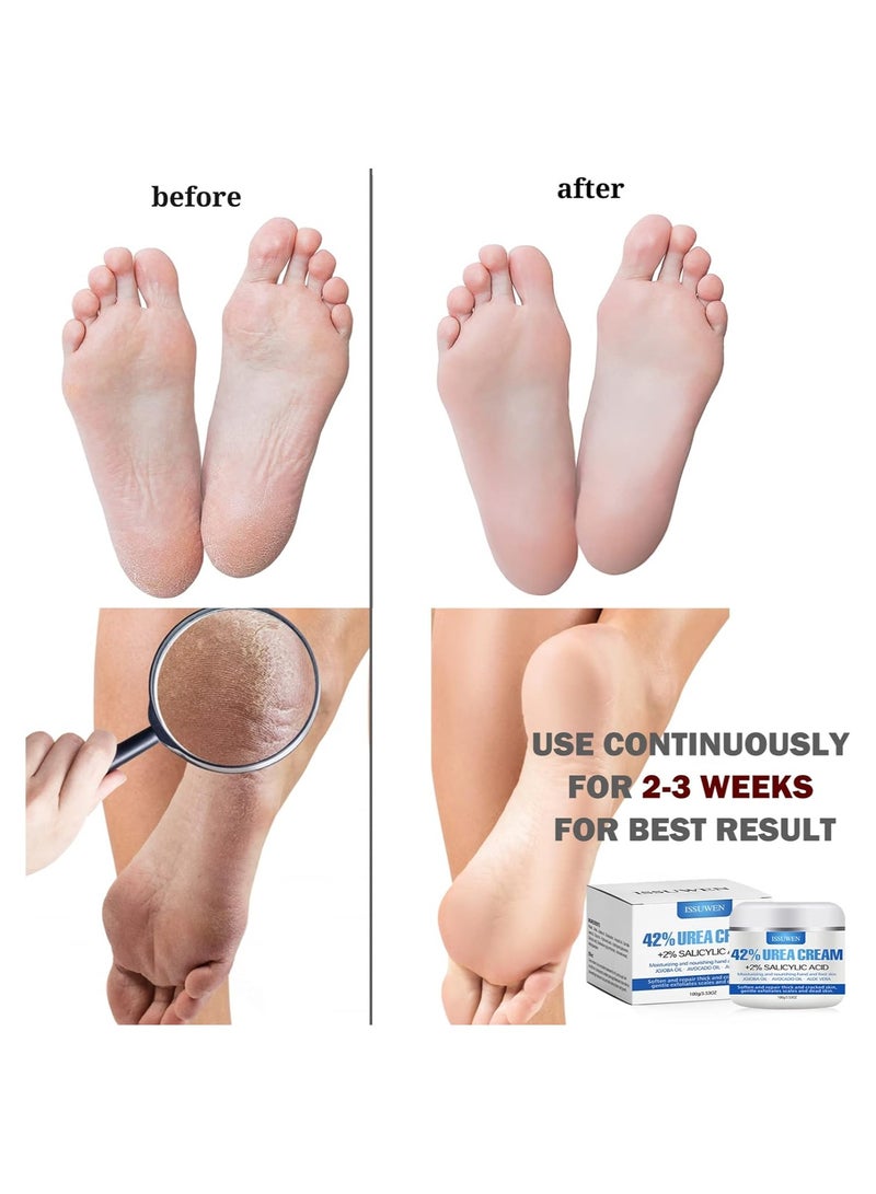 ISSUWEN Urea 42% Foot Cream, Cracked Heel Repair Cream For Feet and Hand, Callus Remover For Dry And Hard Skin, Maximum Strength With 2% Salicylic Acid for Hand, Foot and Body Care, 100g - Image 3