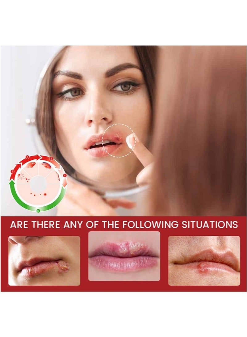 سوميفون كريم لتخفيف القروح الباردة، قطعتين، يخفف القروح الباردة في الفم والشفاه، يخفف الألم والحكة، يوفر تبريدًا فوريًا وتسكينًا للألم، مناسب للشفاه (20 جم + 20 جم) - Image 2