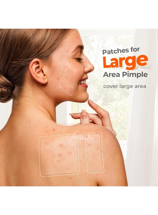 اكني باتش 302 قطعة من رقعة البثور الكبيرة للوجه، 7 أحجام من رقعة حب الشباب، رقعة هيدروكولويد كبيرة للجسم والذقن والجبهة والصدر والظهر، تخفف من ظهور حب الشباب والرؤوس السوداء، خفيفة وغير مزعجة - Image 3