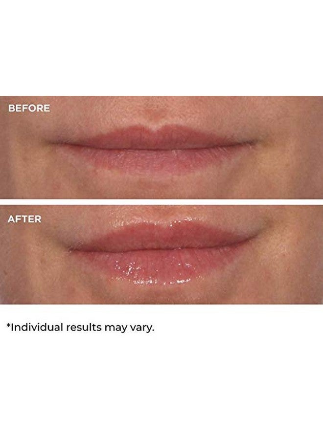 nassif md NassifMD Hydro-Screen for Lips - Image 4