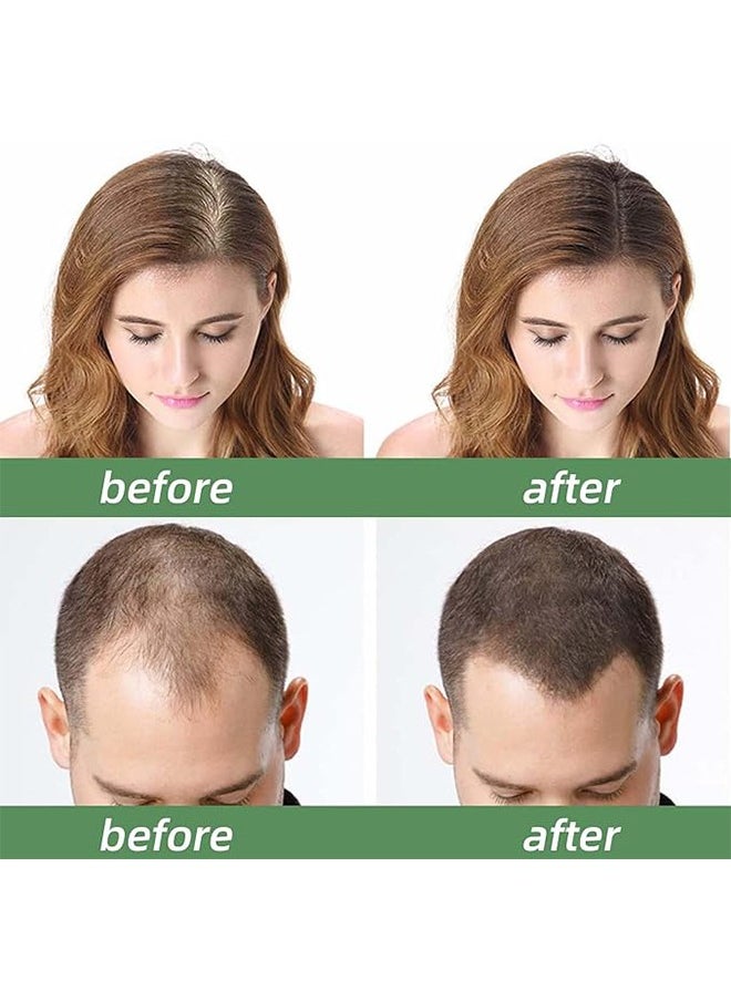 Generic - Rosemary Mint Scalp & Hair Strengthening Oil 59 ml，Promotes Hair Eyebrow and Eyelash Growth for Men and Women - Image 1