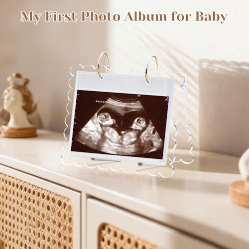 Mlatnod Flip Ultrasound Photo Album with Stand, Refillable Flip-Through Display for 3x4 Pictures, Acrylic Scalloped Cover, Pregnancy Gift for New Parents (Small) - Image 2