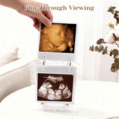 Mlatnod Flip Ultrasound Photo Album with Stand, Refillable Flip-Through Display for 3x4 Pictures, Acrylic Scalloped Cover, Pregnancy Gift for New Parents (Small) - Image 3