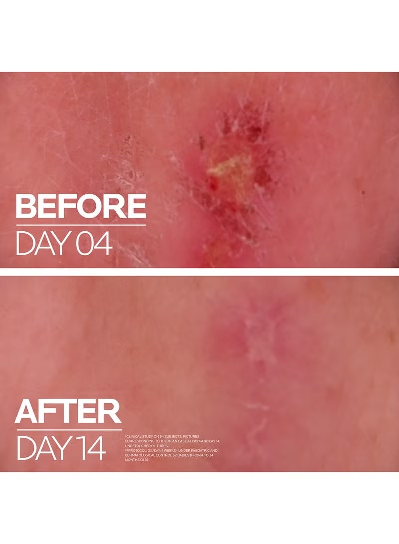 LA ROCHE-POSAY Cicaplast Baume B5+ Ultra Reparing Soothing Balm 100Ml - Image 4