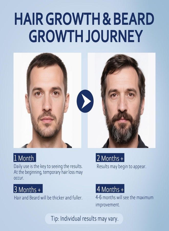 Artimore 5% Minoxidil Hair Growth Serum for Men & Women with Biotin: Minoxidil for Men and Women, 5 Percent, Hair Regrowth Treatment, Extra Strength, 4 Fluid Ounces (2 Bottles) - Image 5