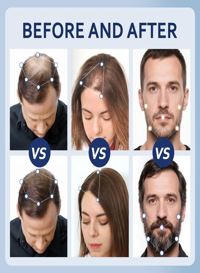 Artimore 5% Minoxidil Hair Growth Serum for Men & Women with Biotin: Minoxidil for Men and Women, 5 Percent, Hair Regrowth Treatment, Extra Strength, 4 Fluid Ounces (2 Bottles) - Image 4