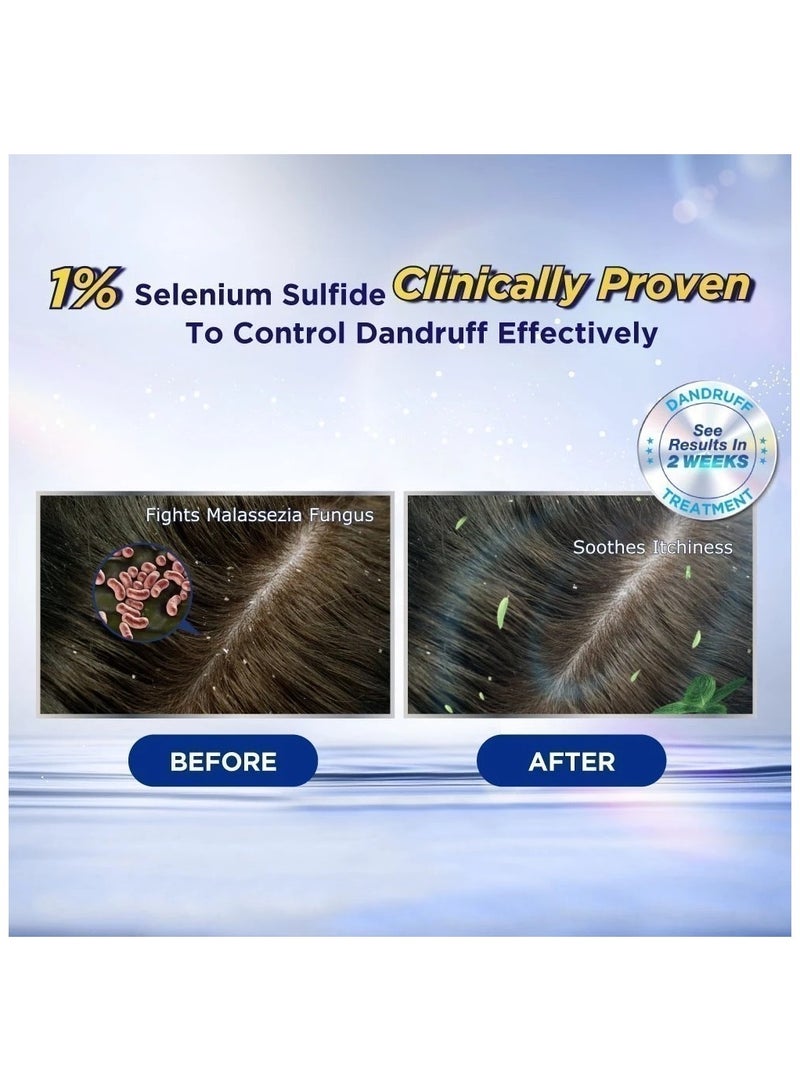 سلسن بلو شامبو مضاد للقشرة بقوة إضافية من سيلسون بلو برو - عبوتان، 120 مل لكل منهما | علاج قوي للقشرة، مرطب فائق وتهدئة فروة الرأس المصابة بالحكة - Image 2