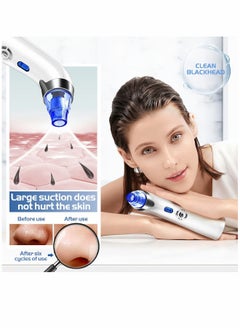 Blackhead Remover Pore Vacuum - Facial Pore Cleaner - Electric Acne Comedone Whitehead Extractor Tool w/5 Suction Power, 4 Probes, USB Rechargeable Blackhead Vacuum Removal Kit for Women & Men (Blue)