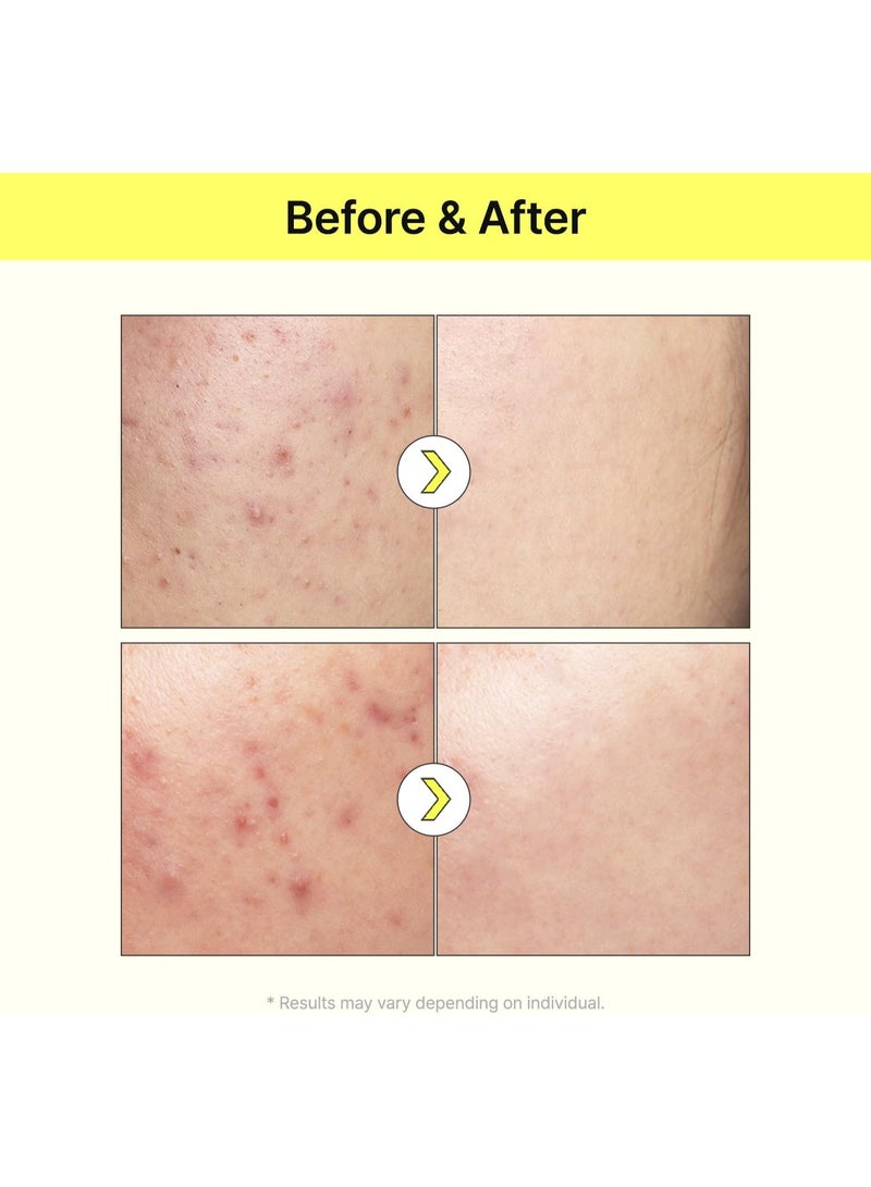 TIA'M TIAM Vita B3 Source, Niacinamide Serum, 10% Niacinamide (Vitamin B3), 2% Arbutin Serum, Age spot, Hyperpigmentation, Dark spot, 1.35 Oz - Image 4