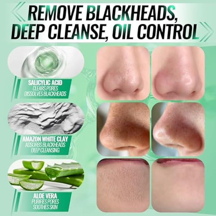 SYABO 2.0 Nose Pore Strips, Blackhead Remover Mask with Salicylic Acid for Face, Upgraded Deep Cleansing Pore Peel Off Mask with 100 PCS Nose Black Heads Remover Strips (1.7 Ounce) - Image 4