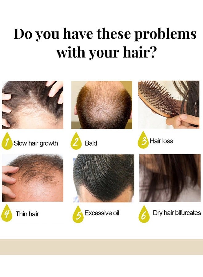 EELHOE Rice Water Shampoo Bar -  Rice Water Solid Shampoo Bar for Hair Growth Rice Water protein Shampoo Bar for Strengthening Weak or Damaged Hair Thinning Hair & Hair Loss Soap 60g - Image 4