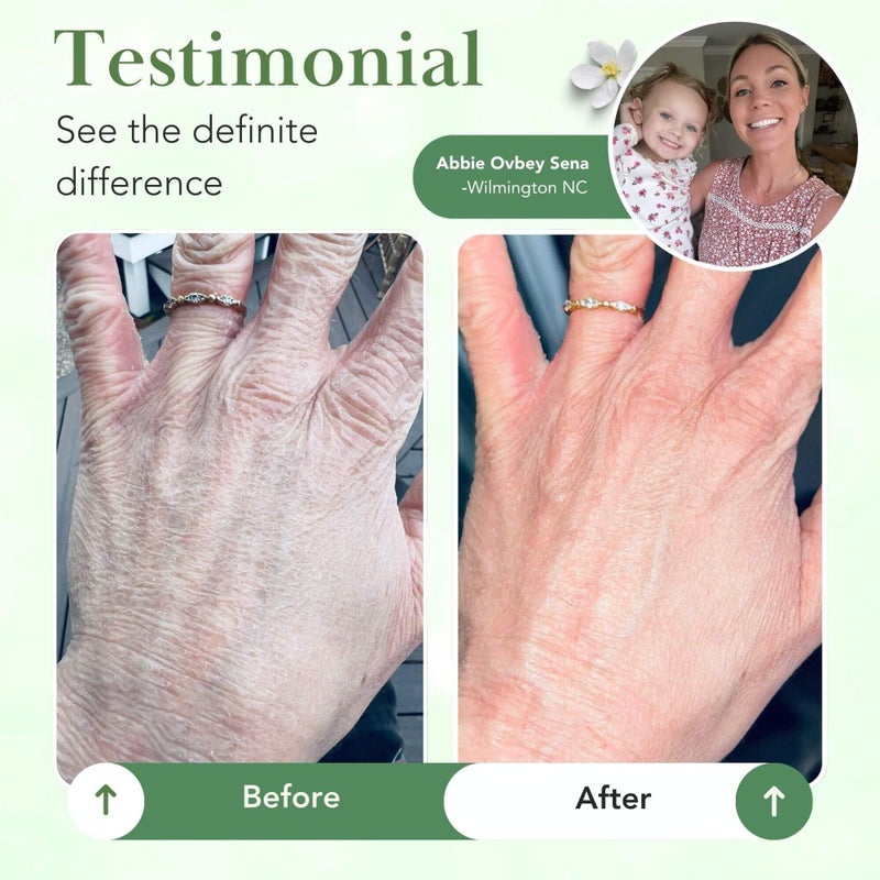 Theraplex مرهم بارير ثيرابليكس لحماية البشرة - كريم مرطب لإصلاح الحاجز الجلدي للجسم للبشرة الجافة والحساسة - خالي من البارابين أو المواد الحافظة، غير كوميدوغينيك ومضاد للحساسية - موصى به من قبل أطباء الجلد - 6 أونصات - Image 3