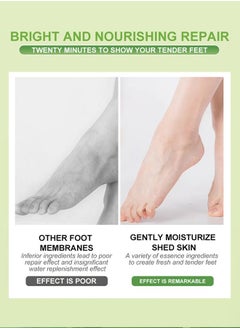 APPTI Foot Peel Mask With Avocado For Dry Cracked Feet 5 Pack-Exfoliating Foot Mask, Natural Exfoliator For Dead Skin,Callus,Repair Rough Heels For Men Women-Repairs Heels & Removes Dead Skin For Soft Feet  - Image 5