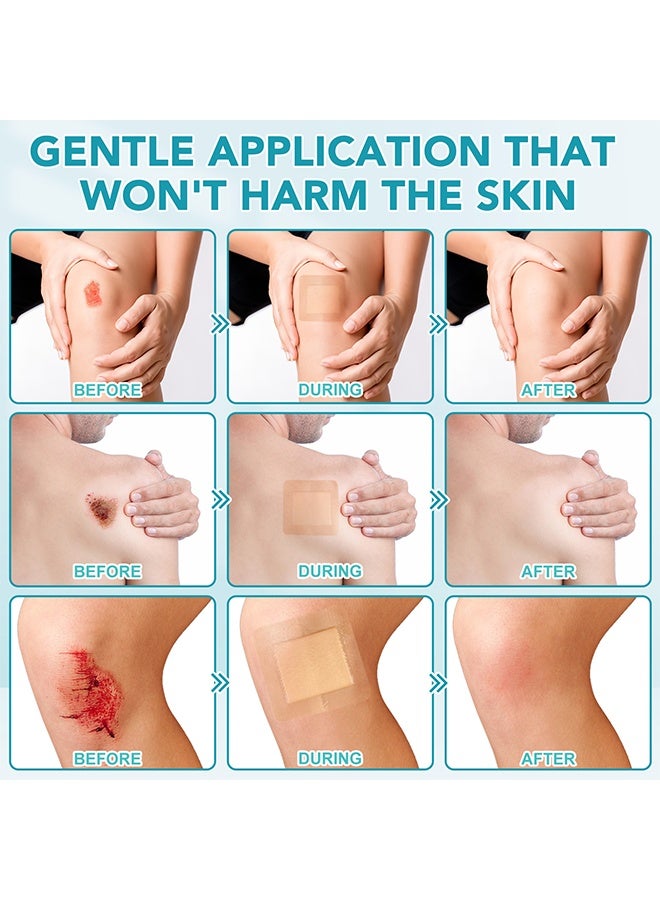 سيفودون 5 قطع ضمادات رغوة سيليكونية مع حواف، حواف لاصقة 10×10 سم، ضمادات رغوية قابلة للتنفس ولطيفة على البشرة، لاصقات عناية ذاتية للأماكن الجرحية - Image 3