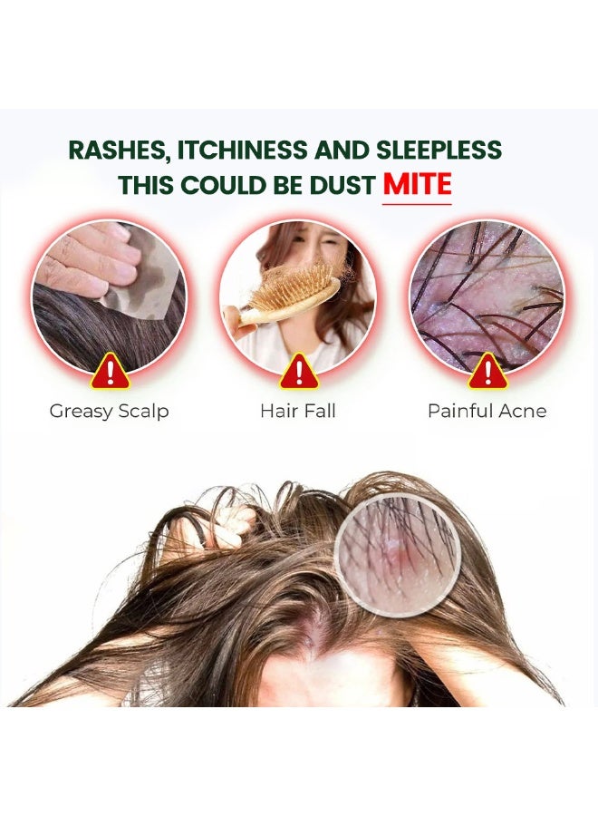 سوميفون كريم سوميفون لإزالة العث، مرهم مضاد للعث بمستخلصات نباتية طبيعية، يخفف الحكة وتهيج الجلد للجسم وفروة الرأس، 30 غرامًا (1.06 أونصة) - Image 2